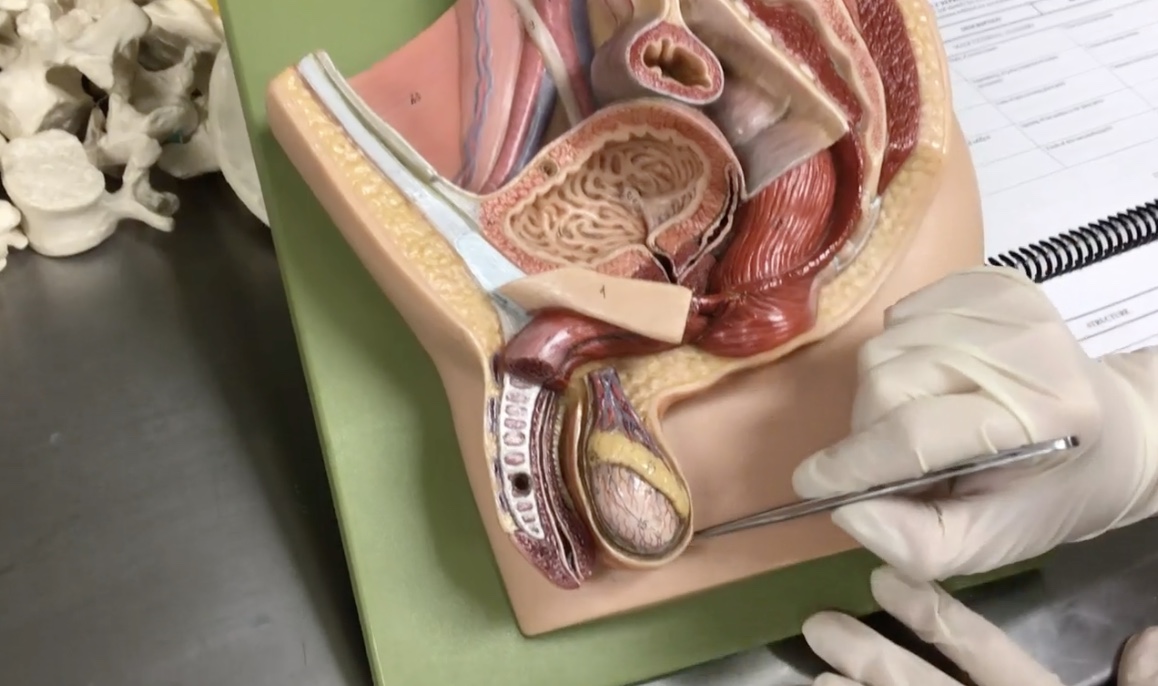 <p>Description: Pouch of skin surrounding testis</p><p>Relationship: Contains the dartos muscle</p>