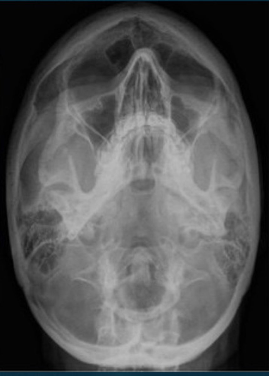 <p>What projection view is this?</p>