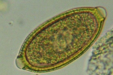 <p>Eucoleus: aerophilus and boehmi</p>