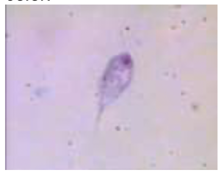 cyst or trophozoite: 

* The anterior flagella and the posterior flagellum
