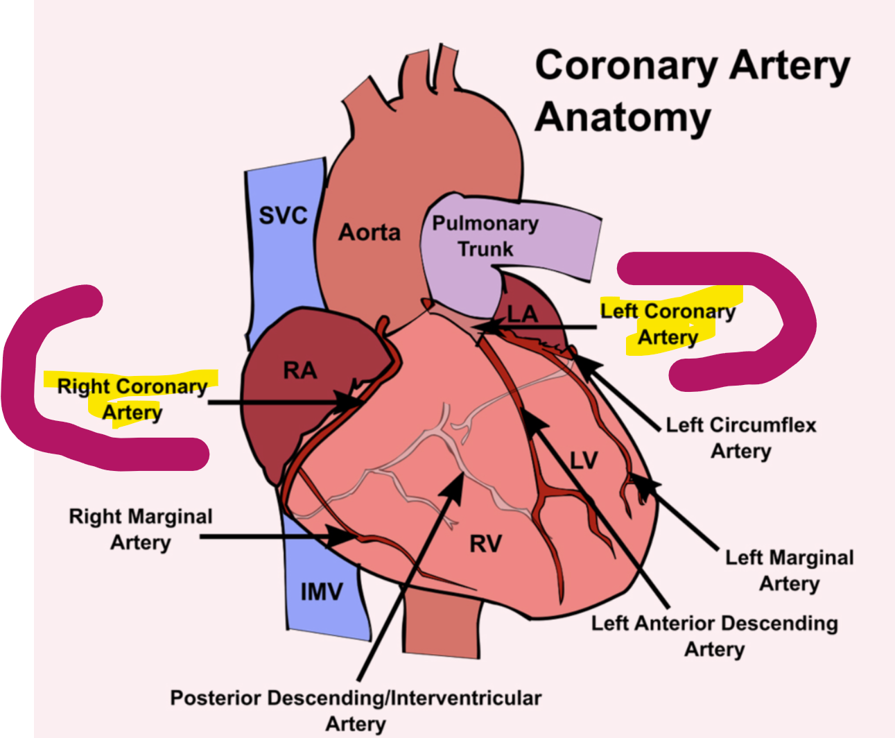 <p><strong>coronary arteries</strong> are blood vessels that supply oxygen-rich blood to the heart. There are two main coronary arteries:</p><ol><li><p><strong>Left Coronary Artery</strong>: Feeds the left side of the heart, including the left ventricle and atrium.</p></li><li><p><strong>Right Coronary Artery</strong>: Feeds the right side of the heart, including the right ventricle and atrium.</p></li></ol><p></p><p></p>
