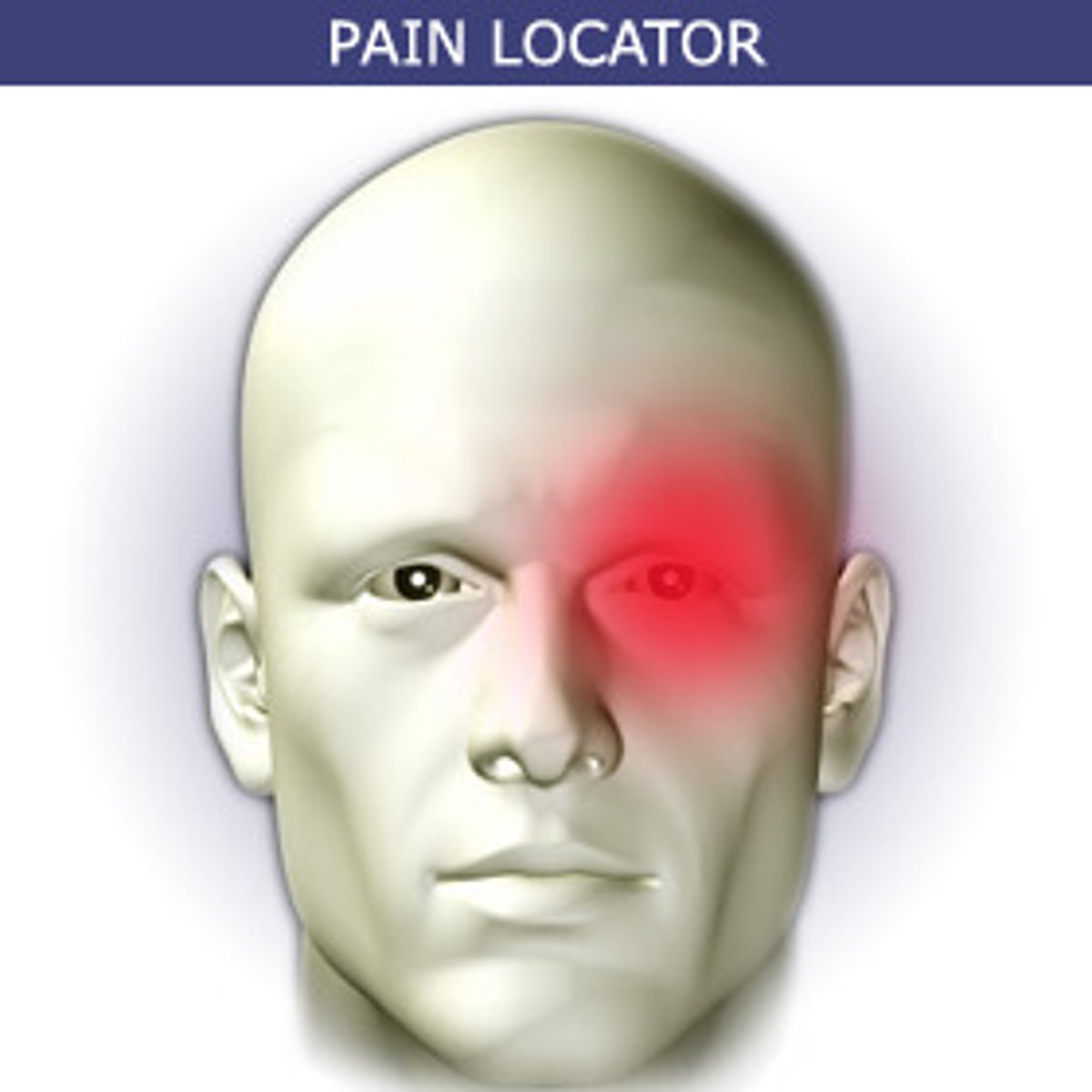 <p>Unilateral, severe periorbital headache with tearing and conjunctival erythema.</p><p>- several attacks at once</p>