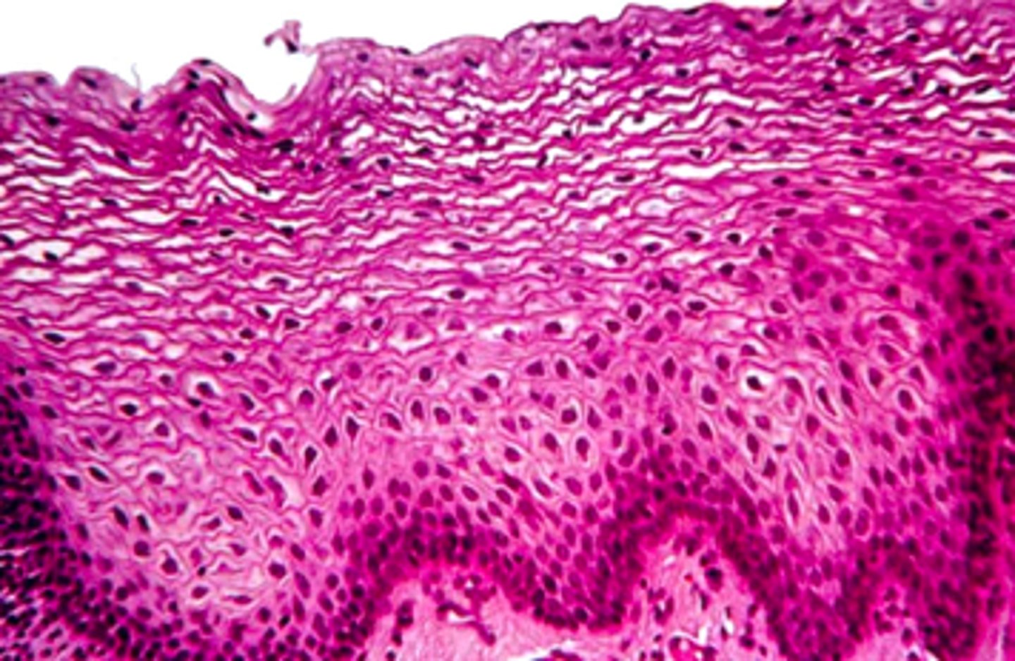 <p><em>identify the mucosa:</em></p>