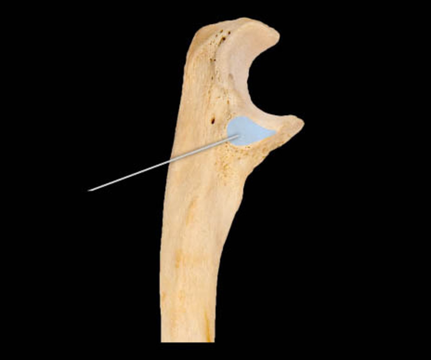 <p>What feature of the ulna is highlighted in the figure?</p>