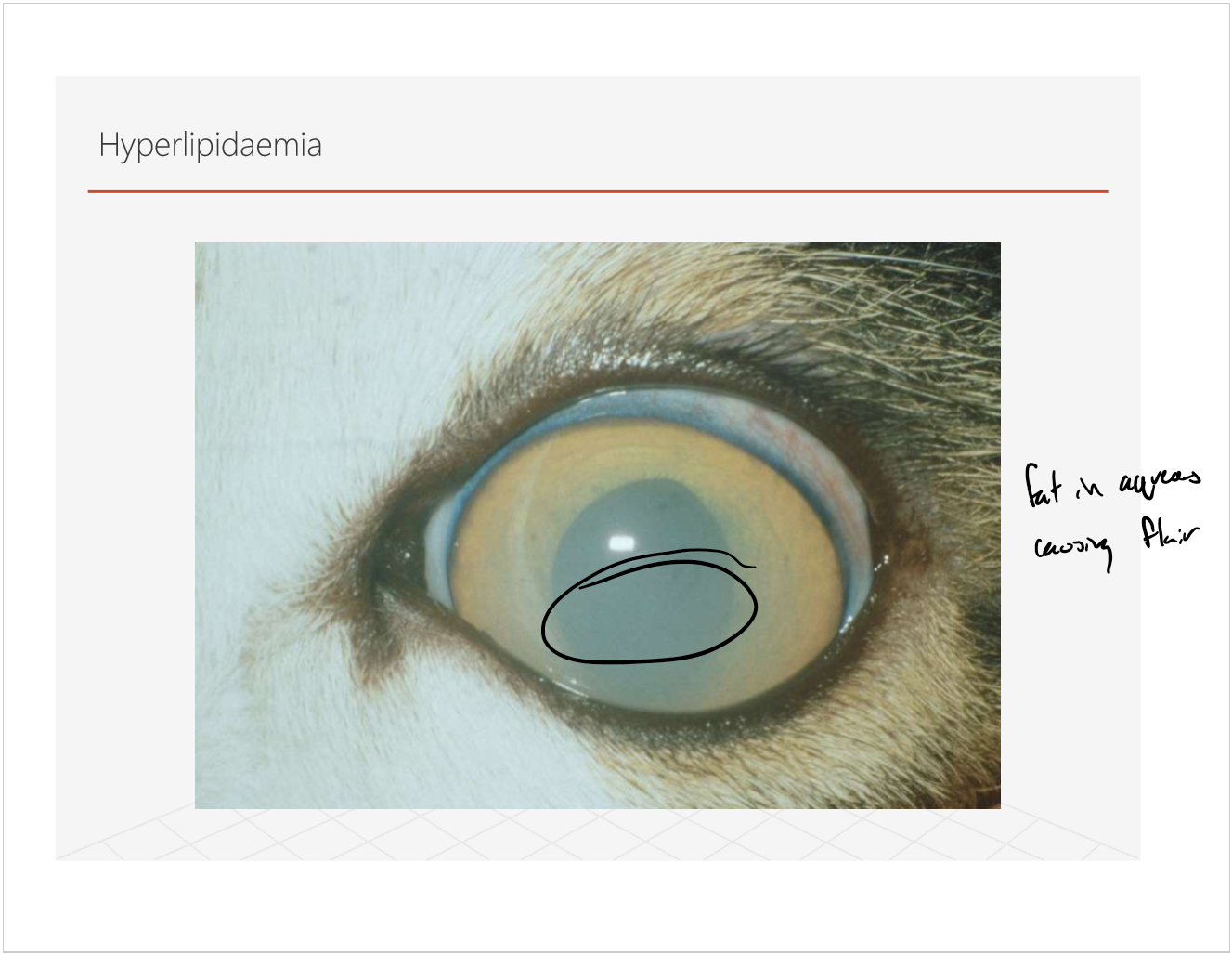 <p><strong>hyperlipidemia</strong></p><ul><li><p>fat in the aqueous causing flare</p></li></ul><p></p>
