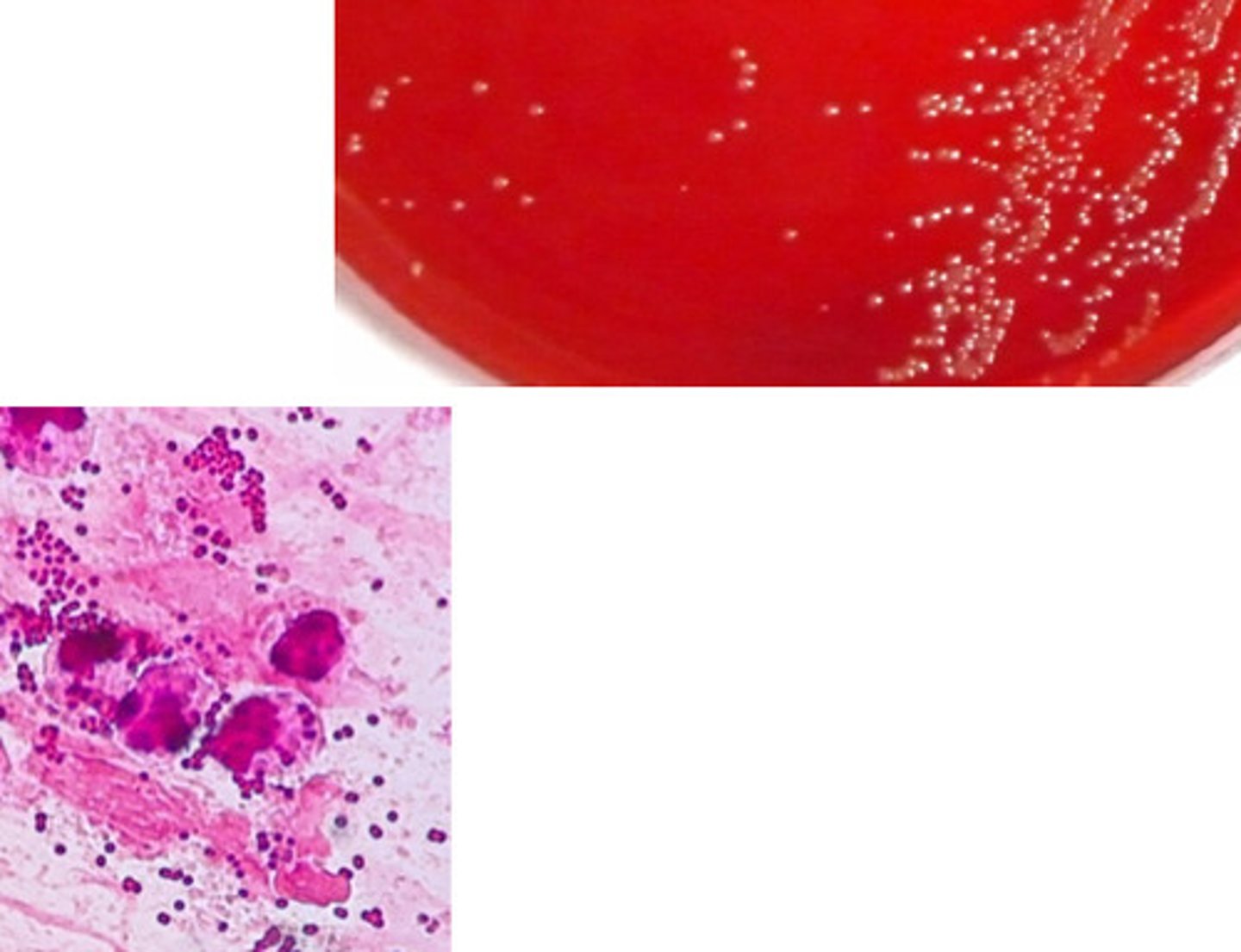 <p>GNC, hockey puck colonies, capnophilic, oxidase pos, catalase pos</p>