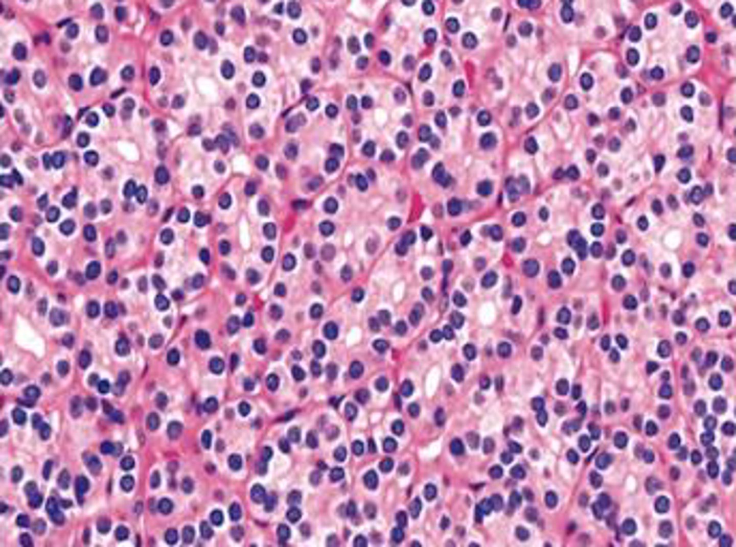 <p>smalll, closelly packed follicles</p>