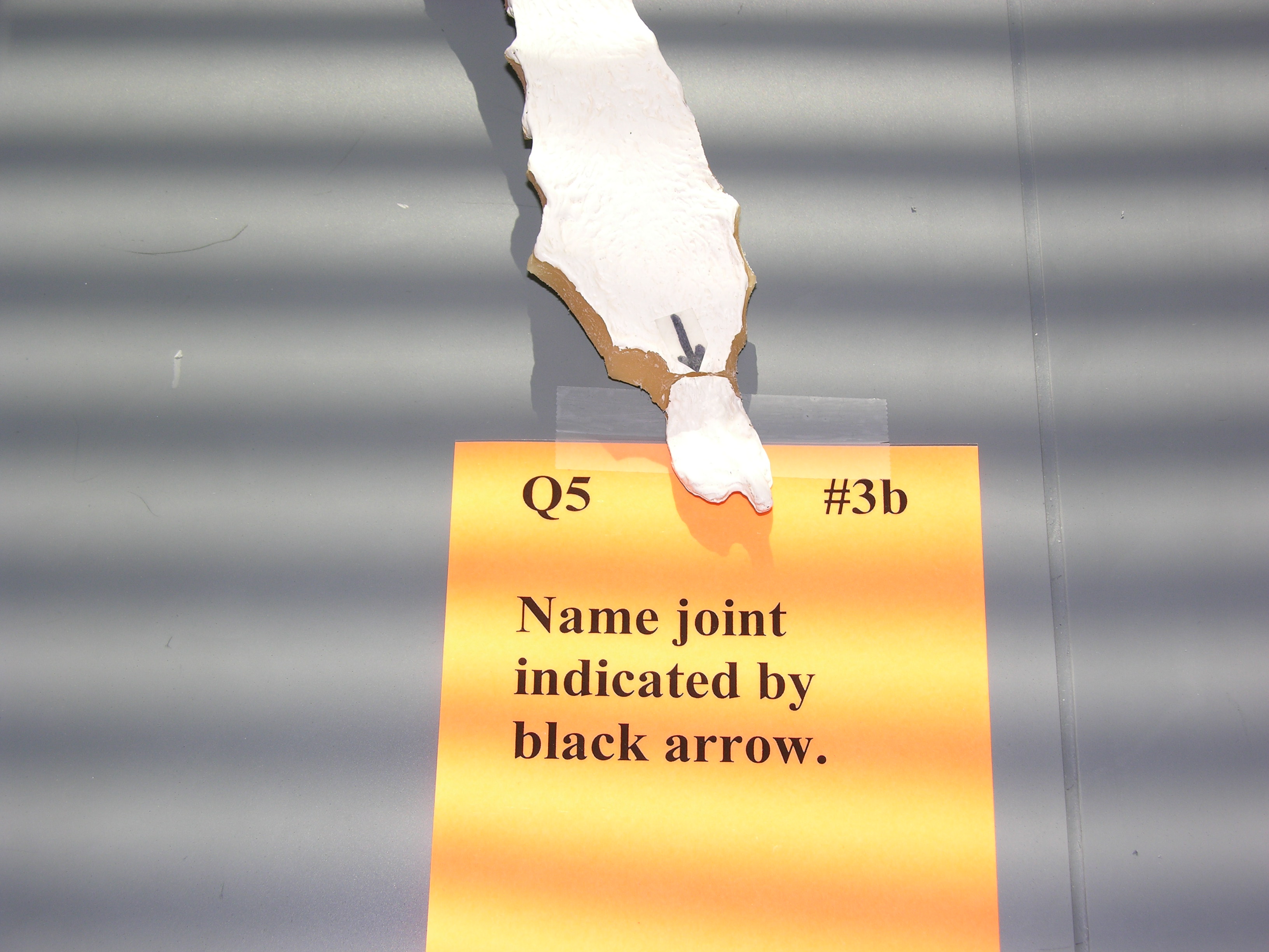 <p><span style="font-family: Lato Extended, Lato, Helvetica Neue, Helvetica, Arial, sans-serif; color: rgb(45, 59, 69)">Name the joint indicated by the black arrow.</span></p>
