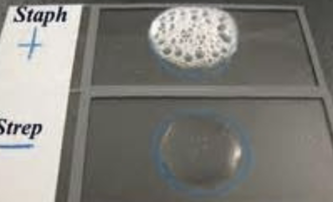 <p>Enzyme Catalase is present </p>