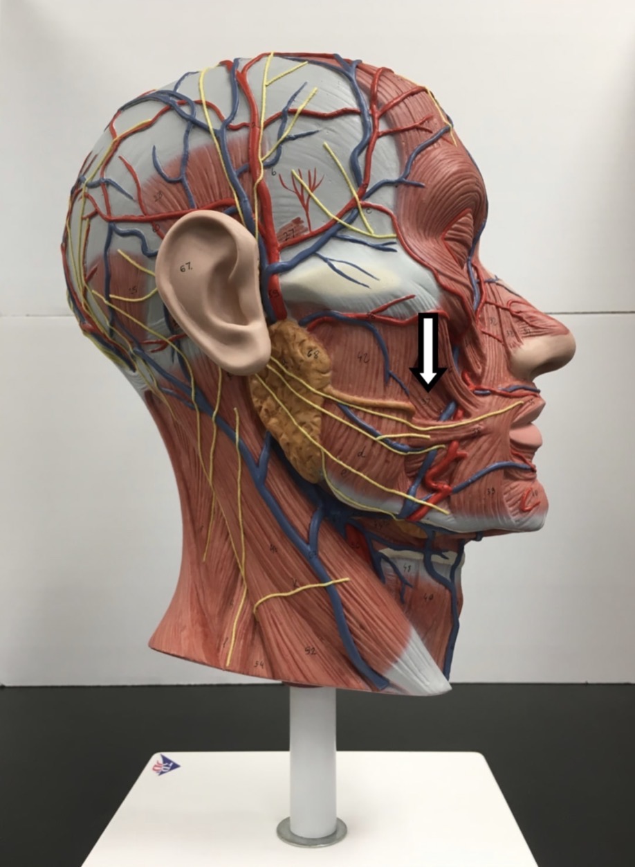 <p><span>Name the muscle labeled with the white arrow below:</span></p>