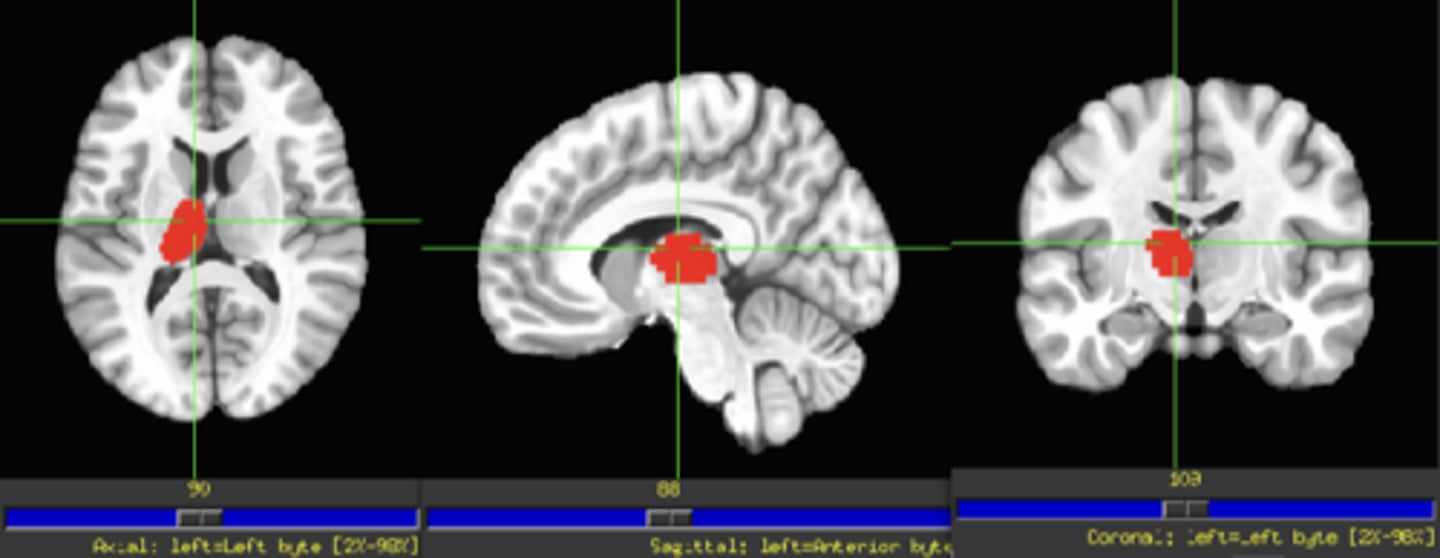 <p>- part of the diencephalon</p>