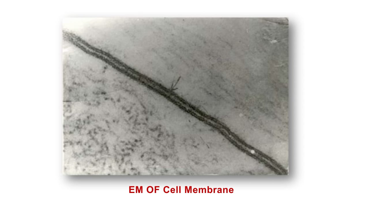 <p>Term 1</p>
