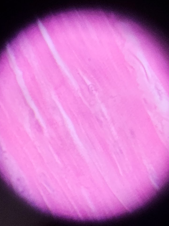 <ul><li><p>Branched tubular fibers</p></li><li><p>Less rows w/more purplish cells</p></li><li><p>Muscle fibers are more visible (pink in color)</p></li></ul><p></p>