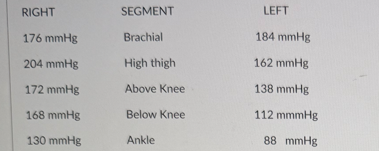 <p>the following segmental pressure measurements are obtained. considering the ABIs for the left leg, how would you grade the severity of occlusive disease in the left leg?</p>