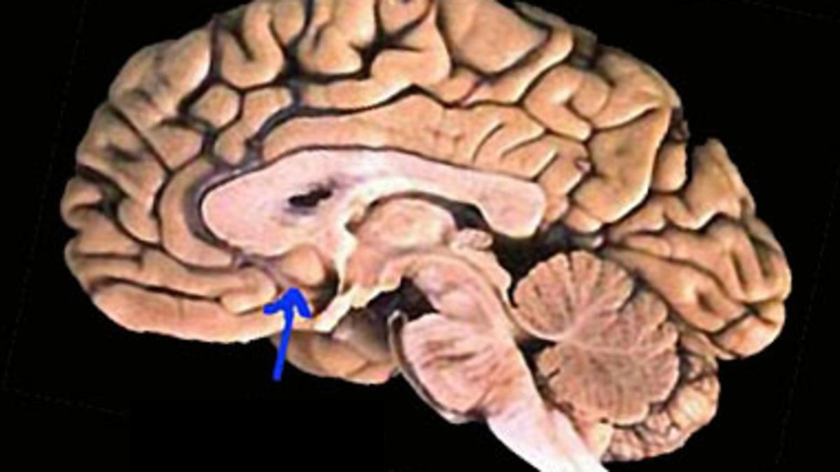 <p>Almond-shaped brain structure that lies beneath the temporal lobe; a major processing center for emotions</p>