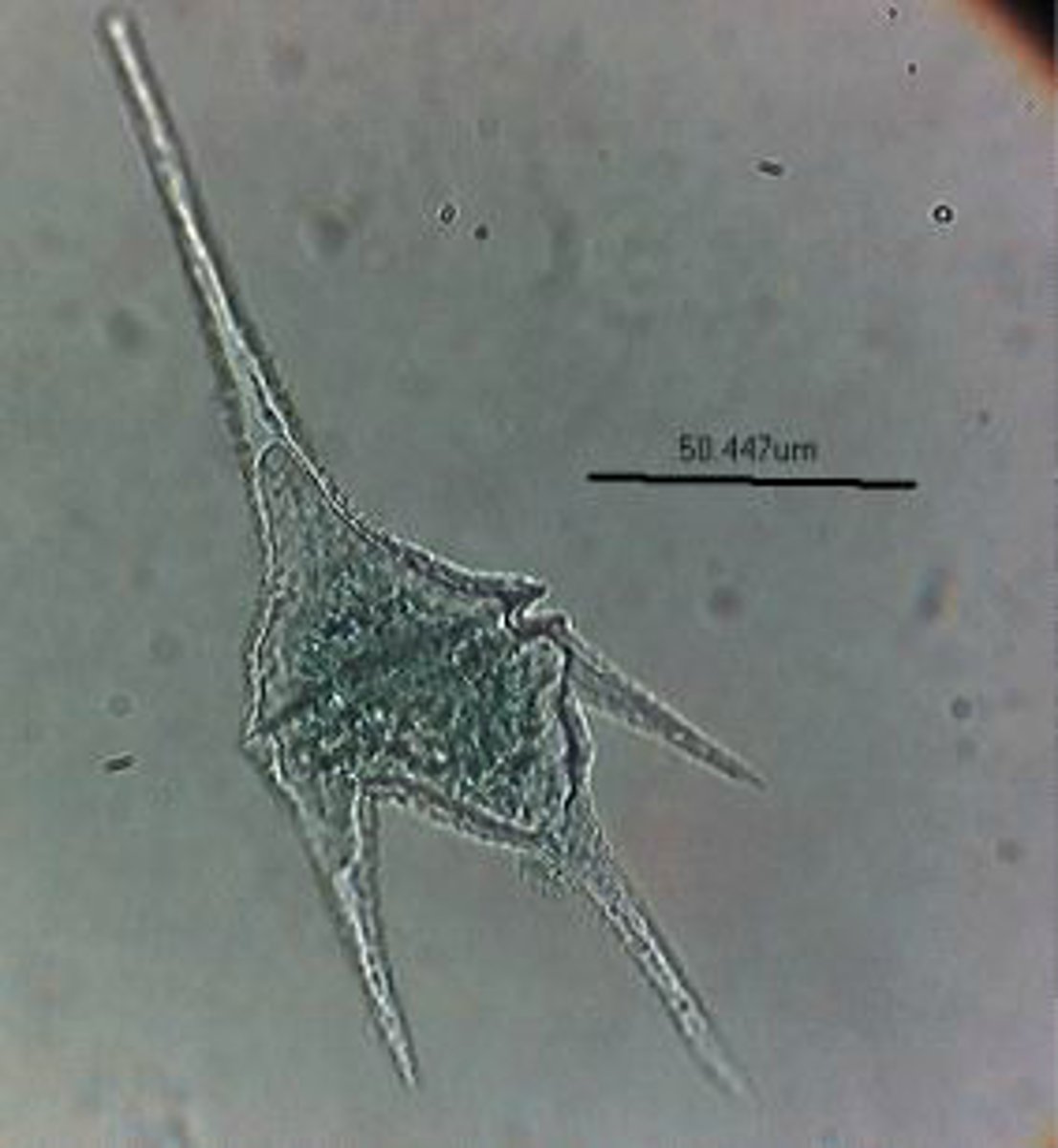 <p>Identify the freshwater dinoflagellate shown</p>