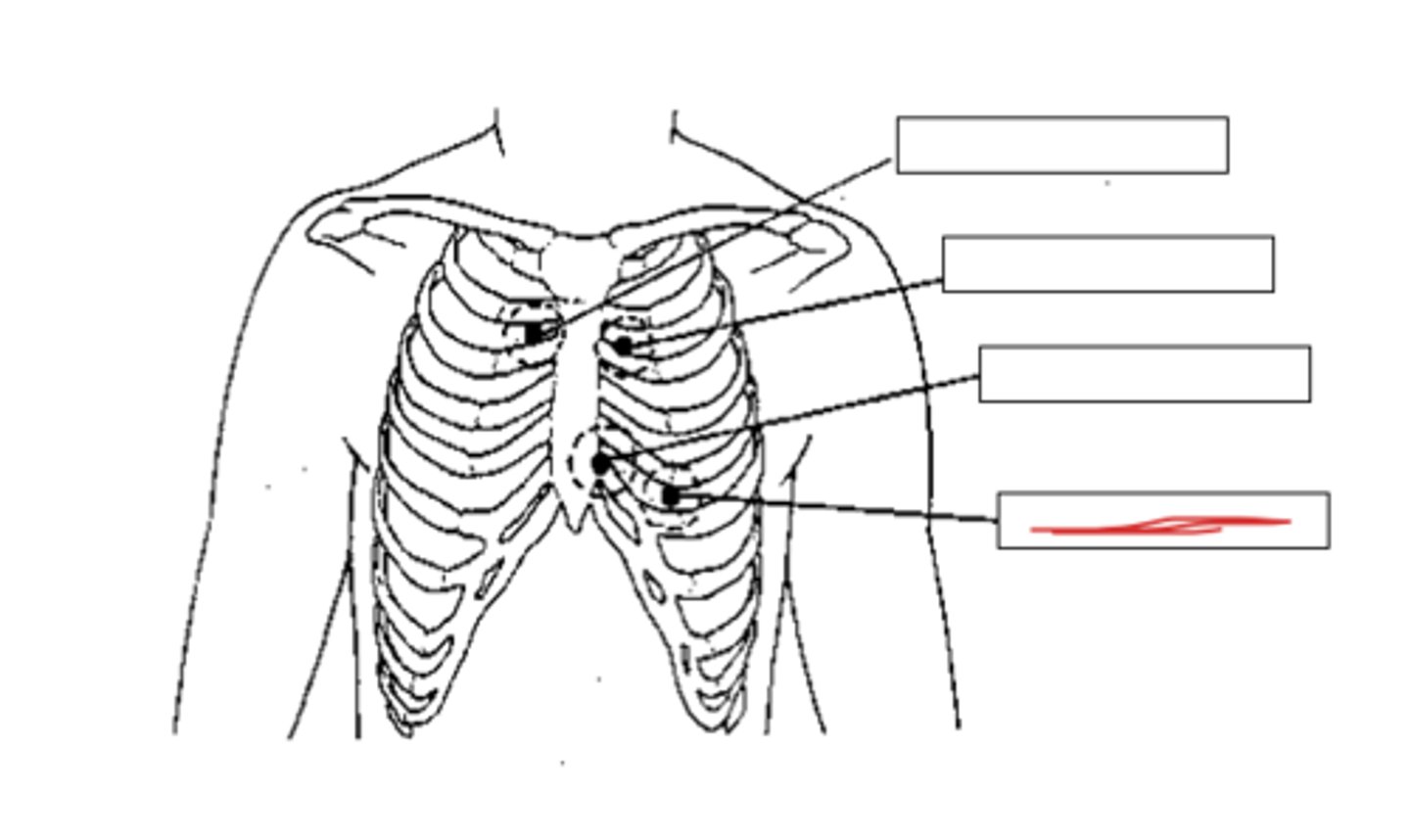 <p>in the fifth intercostal space (between ribs 5 &amp; 6) on the left midclavicular line</p>