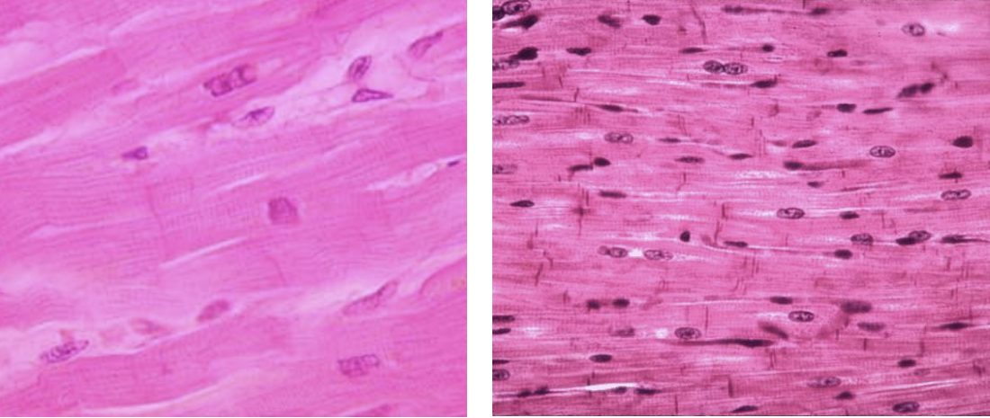 <p>Muscle tissue found in the heart for heart muscle contraction.</p>