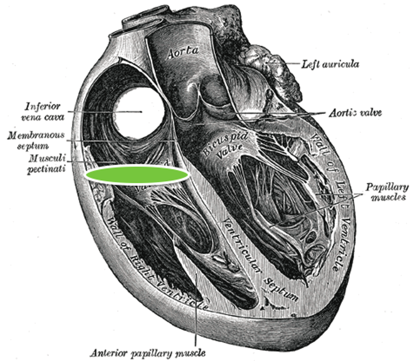 <p>Space, stick probe from atrium to ventricle to open doorway</p><p>H5</p>