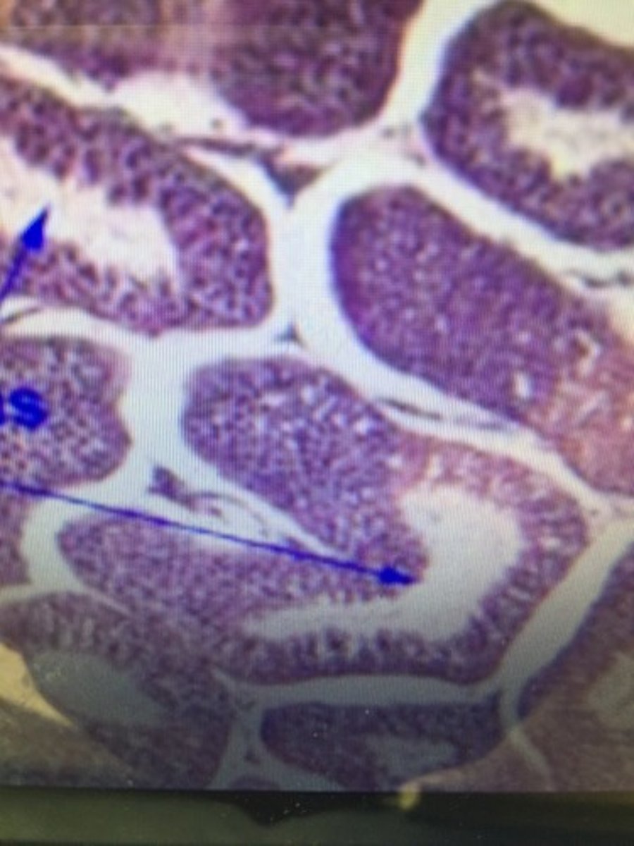 <p>The site of germination, maturation, and transportation of the sperm cells within the male testes</p>