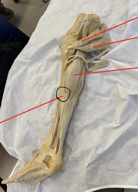 <p>identify + state origin, insertion, action, innervation of marked structure</p>