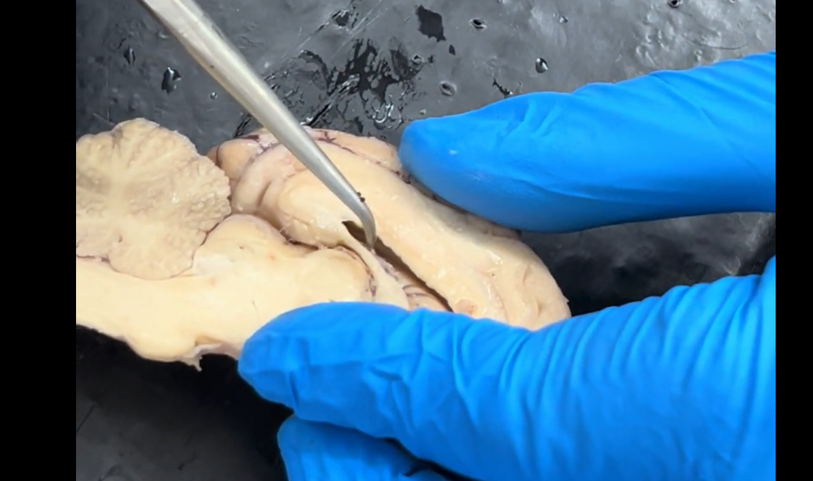 <p>Name the groove that the probe is in.</p>