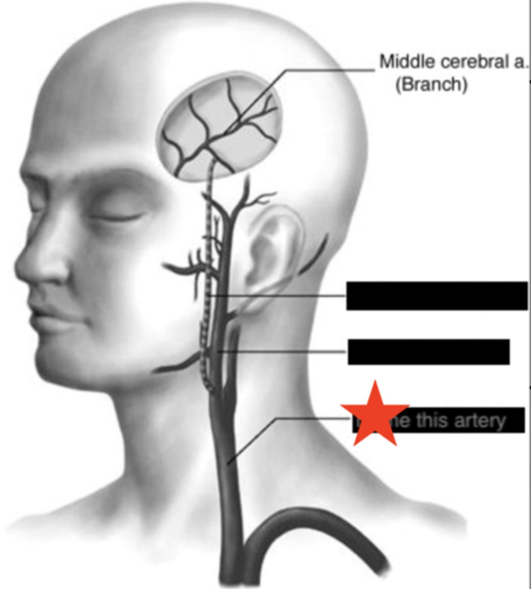 <p>name the starred artery</p>