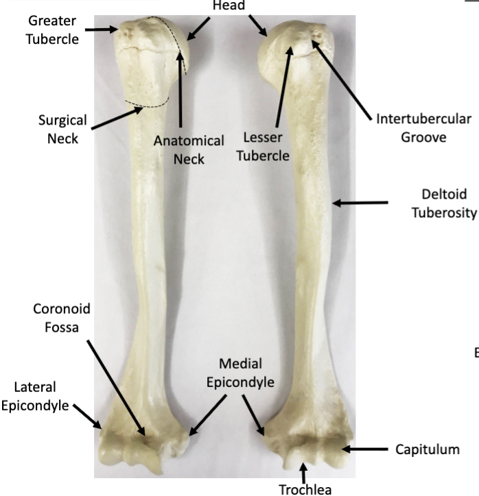 <p>What bone is this?</p>