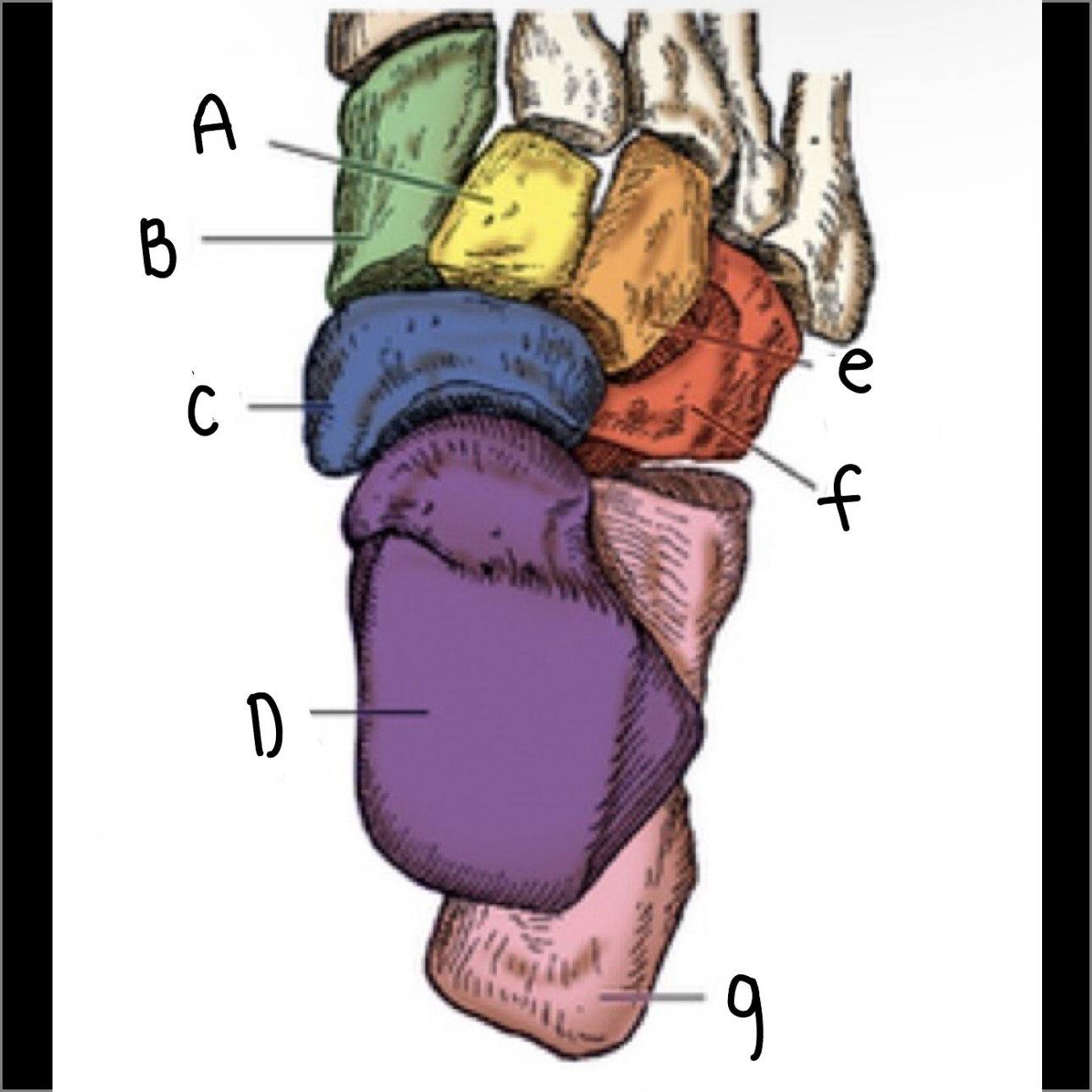 <p>What is letter F pointing to?</p>