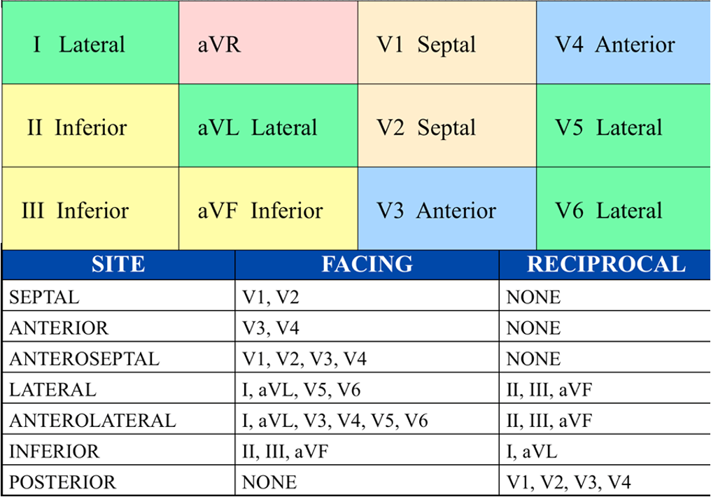 <p>septal: V1, V2 and none</p><p>anterior: V3, V4, and none</p><p>anteroseptal: V1-V4 and none</p><p>lateral: I, aVL, V5, V6 and II, III, aVF</p><p>anterolateral: I, aVL, V3-V6, and II, III, aVF</p><p>inferior: II, III, aVF and I, aVL</p><p>posterior: none and V1-V4</p>