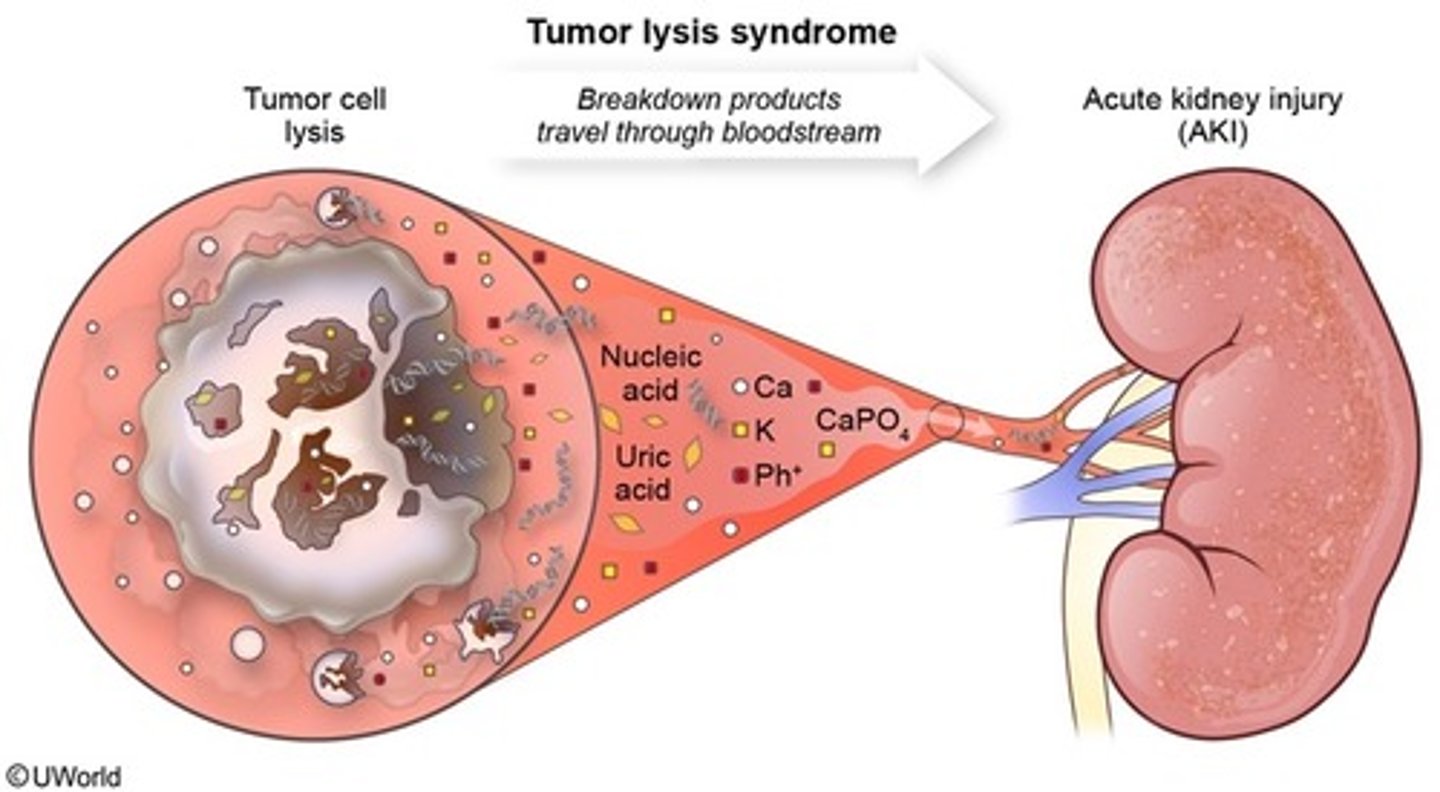 <p>an oncologic emergency with rapid lysis of malignant cells</p><p></p><p>Causes buildup of <strong><span class="bgB">URIC ACID</span></strong></p>