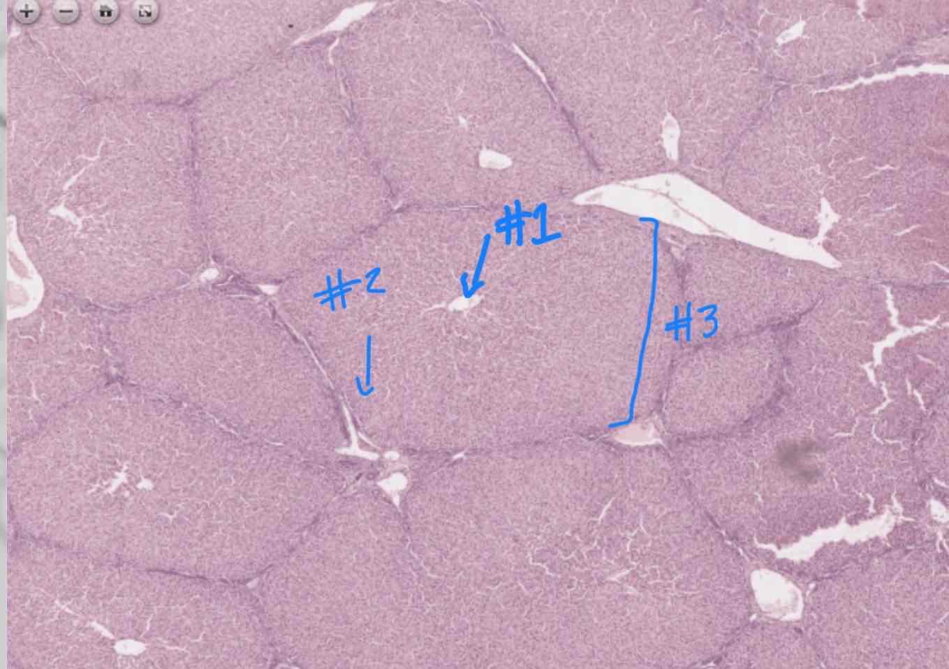 <p>What structure is #3 referring to?</p>