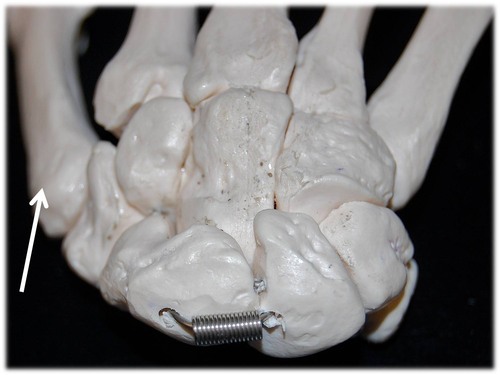 Name this specific bone of the hand (posterior view).