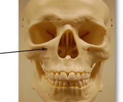 <p>Name this foramen. </p>