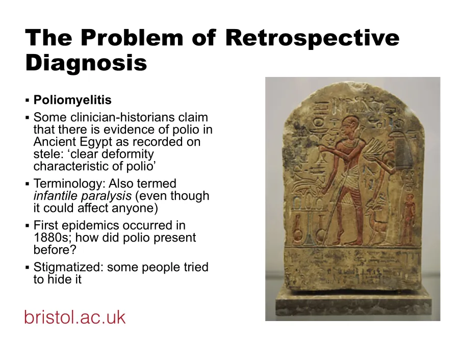 <p>way he limps - this man polio survivor?</p><p>how do we account for earlier case studies?</p>