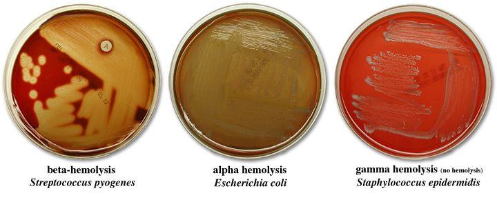 <p>complete lysis of RBCs which leaves a yellow hue</p>