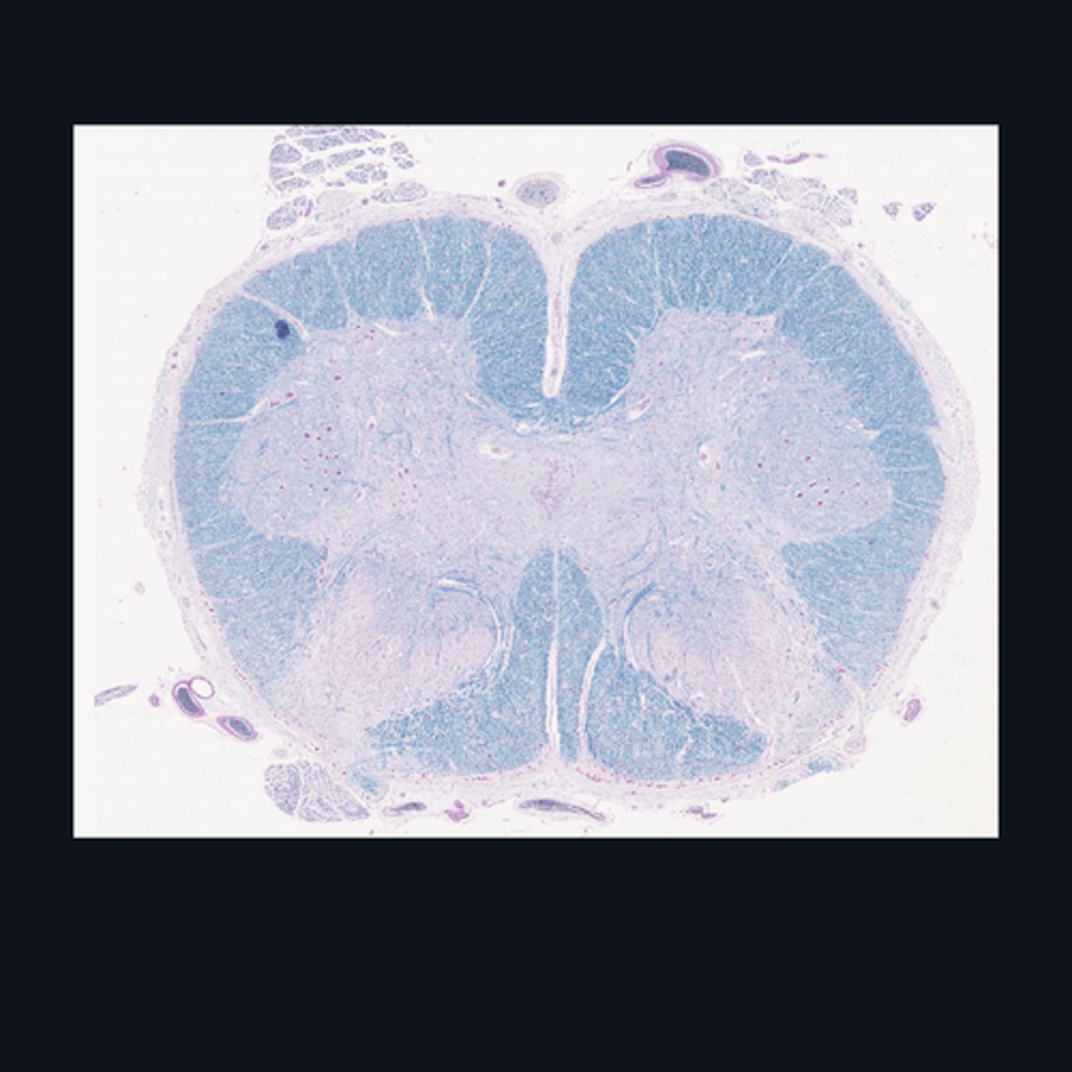 <p>Identify the region of the spinal cord in the given image.</p>