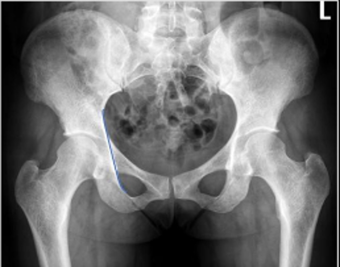 <p>What is the name of the assessment?</p>