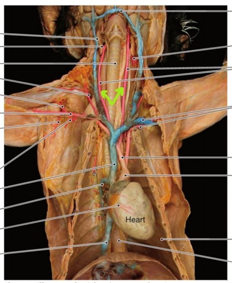 <p>identify this artery</p>