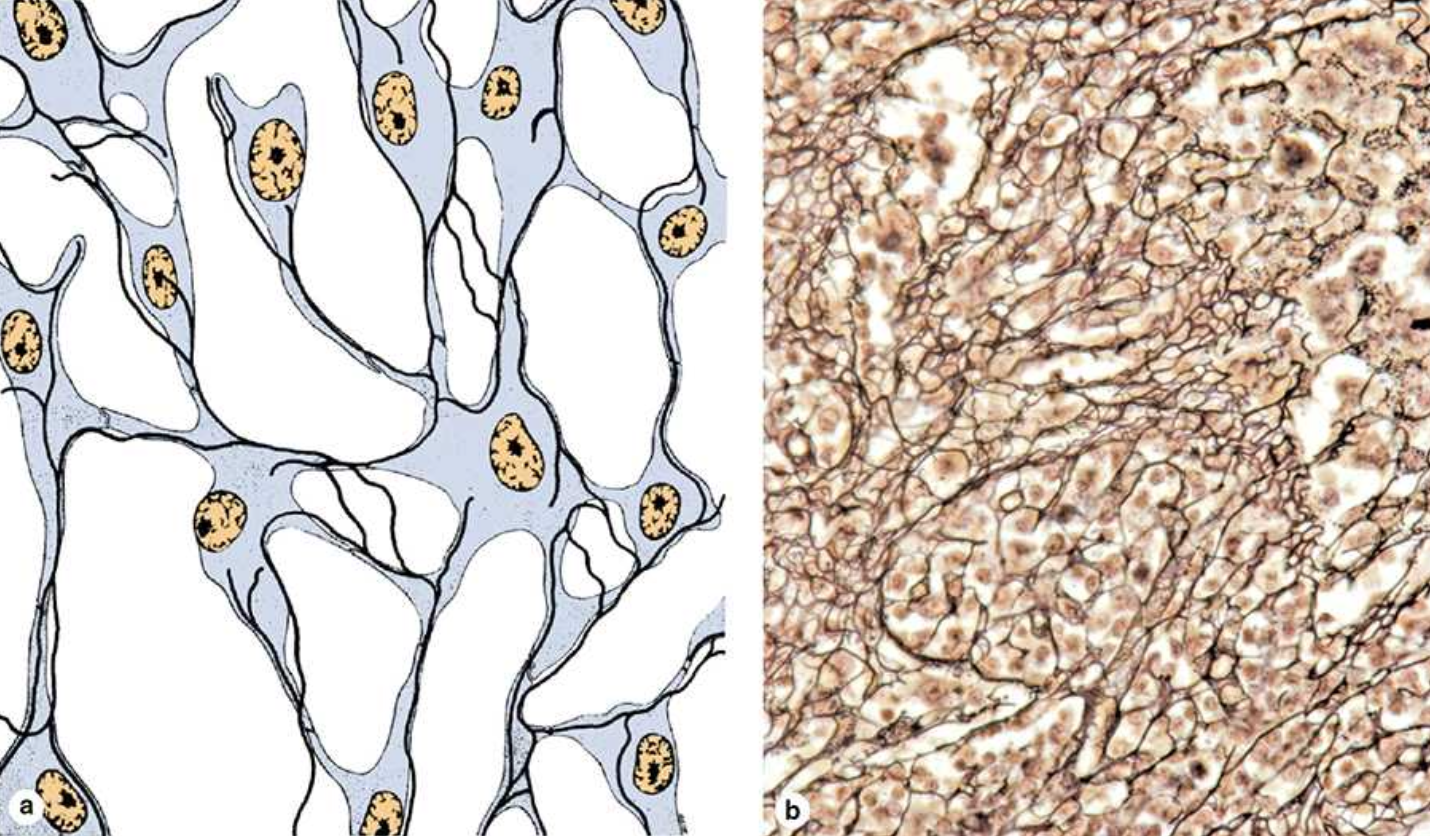 <p>Reticular fibers</p>