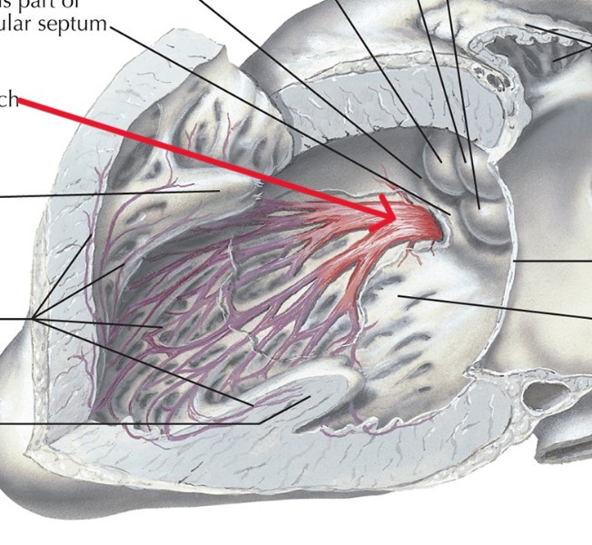 <p>Which part of the conduction system is this?</p>