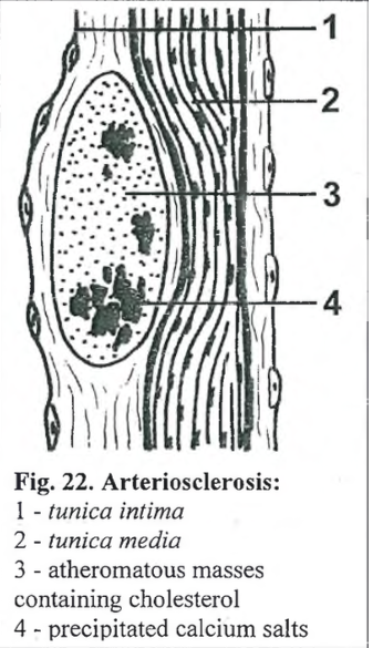 <p><strong>Dystrophic calcification</strong> (infarctus renis anemicus)</p><img src="https://knowt-user-attachments.s3.amazonaws.com/c4fdb554-b136-4737-af72-b230fefafb61.png" data-width="75%" data-align="center"><p></p>