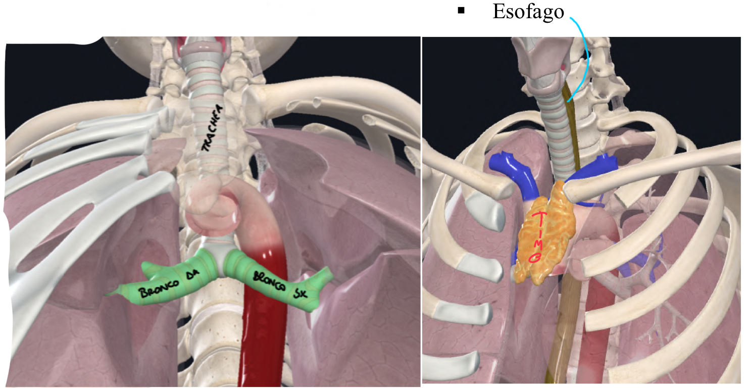 <p>Nella cavità toracica, tra le due logge polmonari è presente il MEDIASTINO, diviso dal piano trasverso del torace in superiore e inferiore.</p><p>Piano trasverso del torace:</p><ul><li><p>Limiti → angolo sternale, seconda costa e disco intervertebrale T4-5</p></li></ul><p>Contenuto Mediastino Superiore:</p><ul><li><p>Trachea → segue la laringe nel collo, attraversa l’apertura toracica superiore e termina con la biforcazione tracheale dove si divide in bronchi.<br>La trachea presenta uno scheletro cartilagineo incompleto, cioè la parte posteriore che è in rapporto con l’esofago ne è priva.</p></li><li><p>Esofago → posteriormente alla trachea e anteriormente ai corpi vertebrali</p></li><li><p>Timo → anteriormente alla trachea, aorta e vena cava, struttura del sistema linfatico, cui dimensioni cambiano durante il corso della vita, infatti in età pediatrica occupa anche il mediastino inferiore, poi pero riduce di dimensione e occupa solo il superiore</p></li></ul><p>Clinica:</p><ul><li><p>Il prelievo del midollo osseo può essere eseguito dal manubrio dello sterno, ma è una sede meno preferita perché posteriormente ad esso passa l’arco aortico, e quindi si ha il rischio di lesionarlo</p></li><li><p>Infatti la sede di elezione è la cresta iliaca</p></li></ul><p>N.B.</p><ul><li><p>Gli organi descritti sono in riferimento alla posizione supina, la loro localizzazione nel vivente dal cadavere può essere diversa per mancanza di pressione strutture viscerali, anche in posizione eretta queste strutture si portano più in basso.</p></li></ul><p></p>