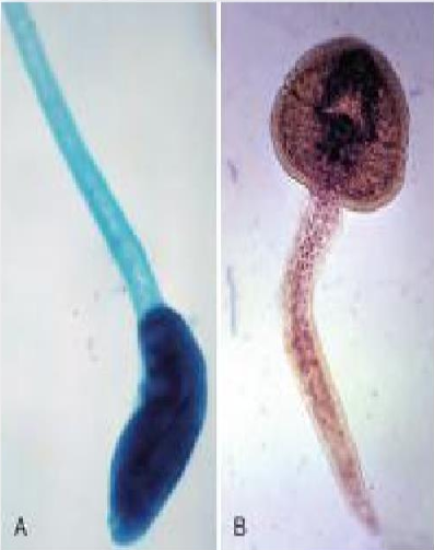 <p>Identify the type of Cercaria based on its Tail</p>