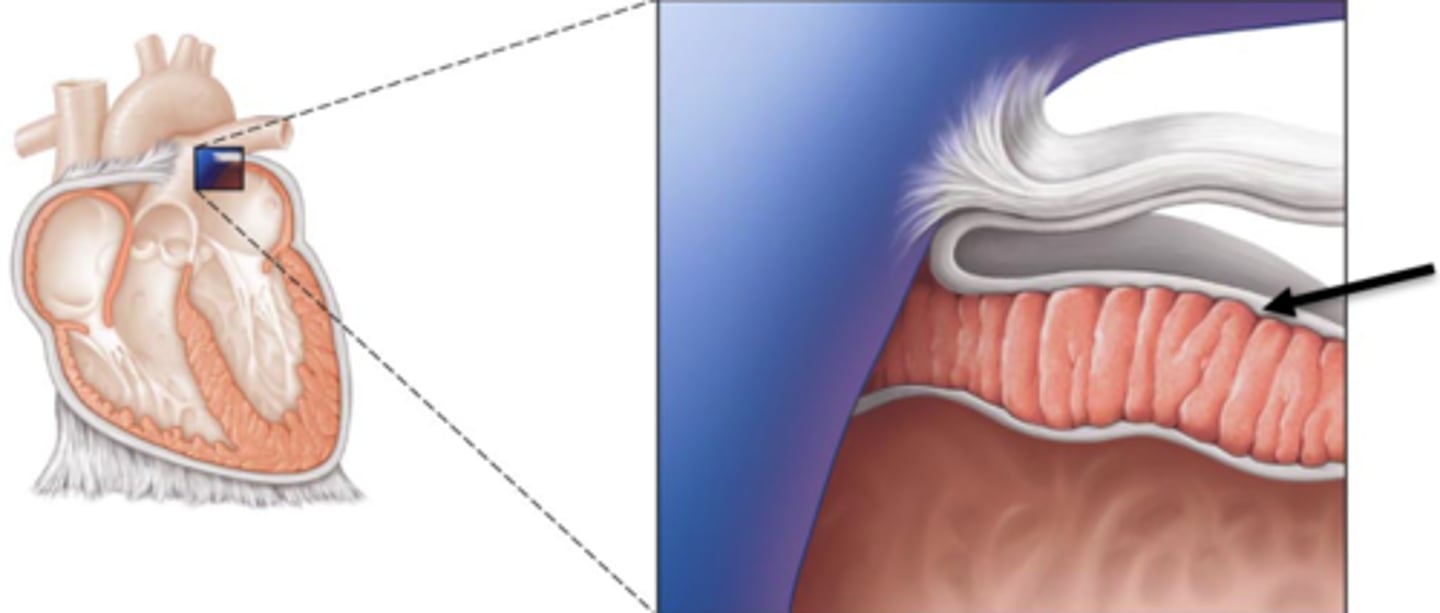 <p>outer layer of the heart</p>