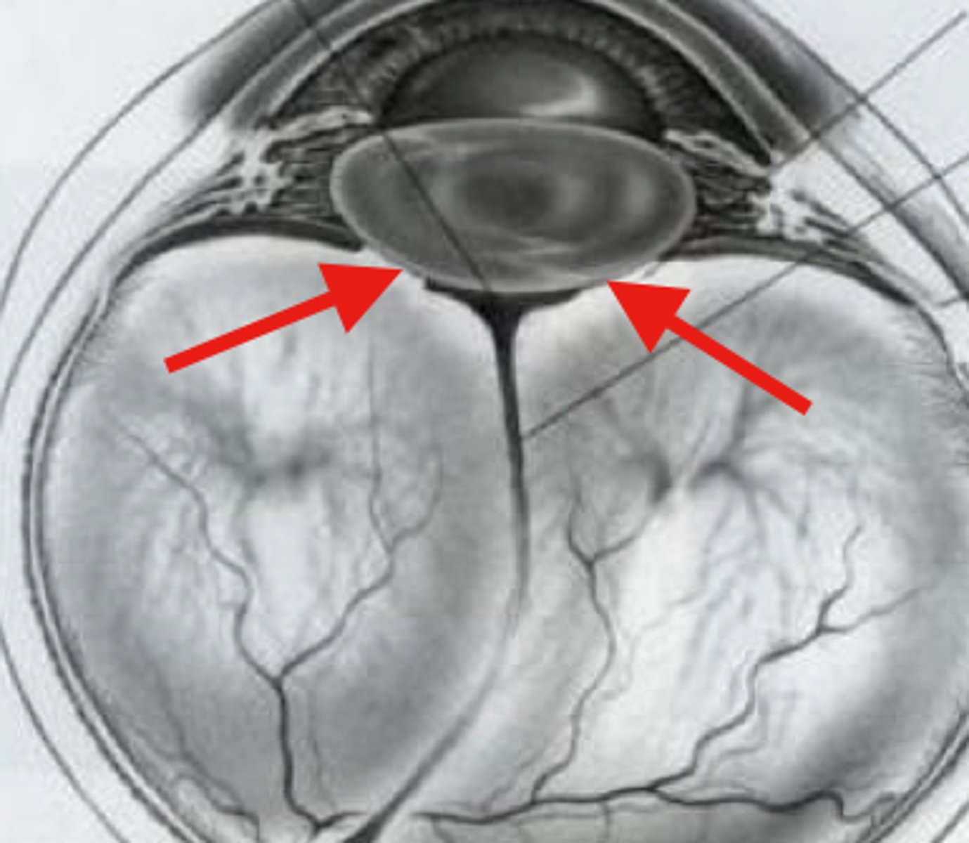 <p>retrolental vitreous attachment</p><p>-Between posterior lens capsule &amp; anterior vitreous cortex</p><p>-Forms Patellar Fossa</p><p>-Forms a ring enclosing Space of Berger (potential space)</p><p>-Weakens with age</p>