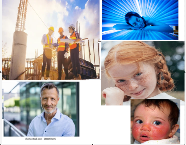 <ul><li><p>Male predominant (but women have been catching up) <em>FYI: cuz men have outdoorsy jobs, women: tanning</em></p></li><li><p>More common in:</p><ul><li><p>fair skin</p></li><li><p>red hair</p></li><li><p>well-freckled people - 10x higher risk of skin cancer</p></li><li><p>people of Irish or Scottish descent</p></li><li><p>people with <strong>xeroderma pigmentosum - </strong>frequently get skin cancer on exposed surfaces</p></li></ul></li><li><p>Rare in black people</p></li><li><p>Peak age is 7th decade in life (people in their 60s) </p></li></ul><p></p>