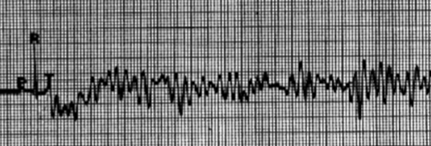 <p>Describe EKG</p>