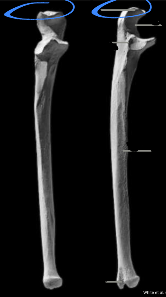 <p>Articulated olecranon, located on the ulna</p>