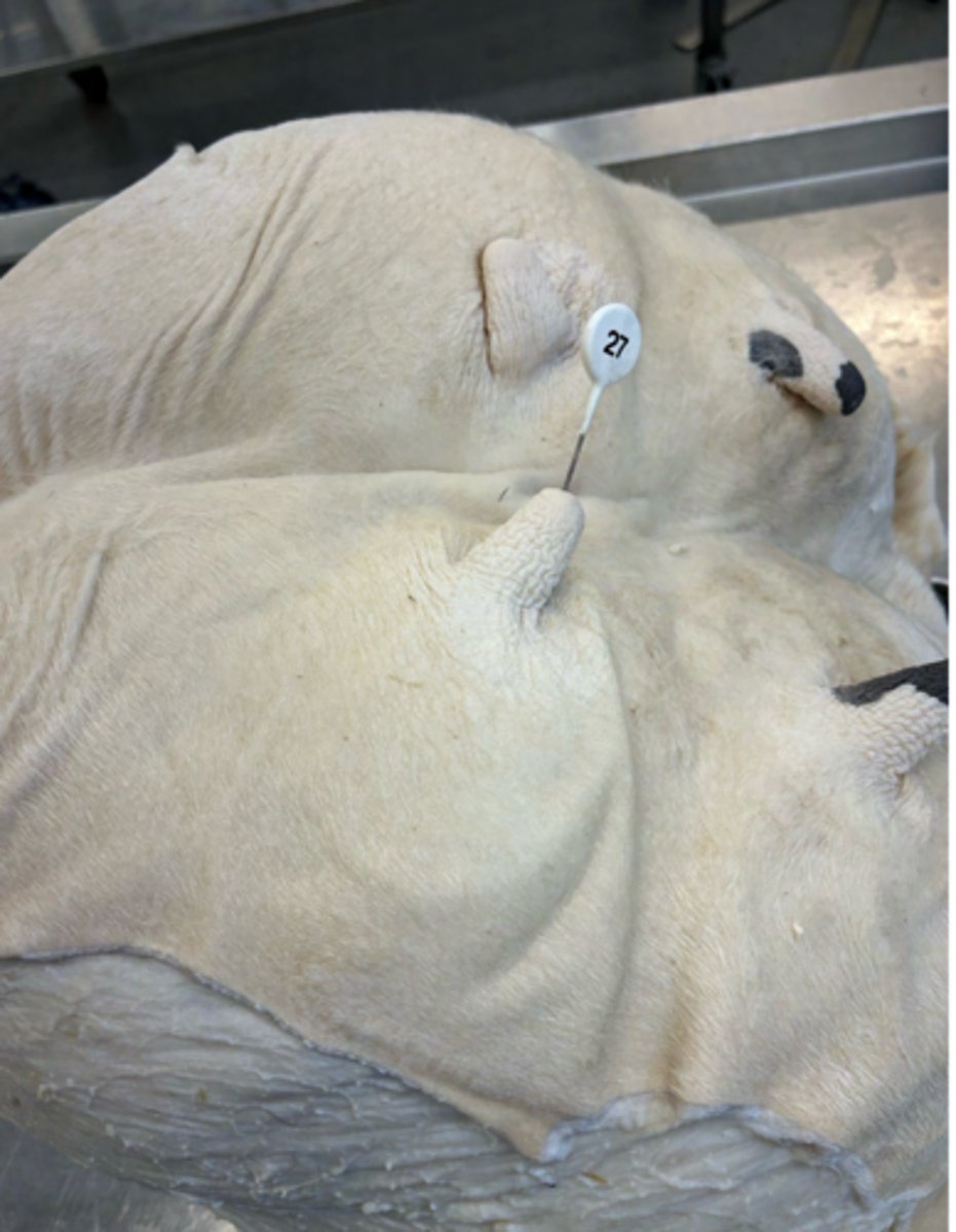 <p>What lymph node do efferent vessels from this region typically drain into first?</p>